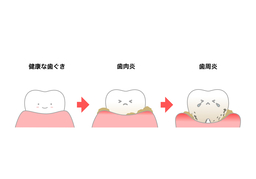 under wayのイラスト
